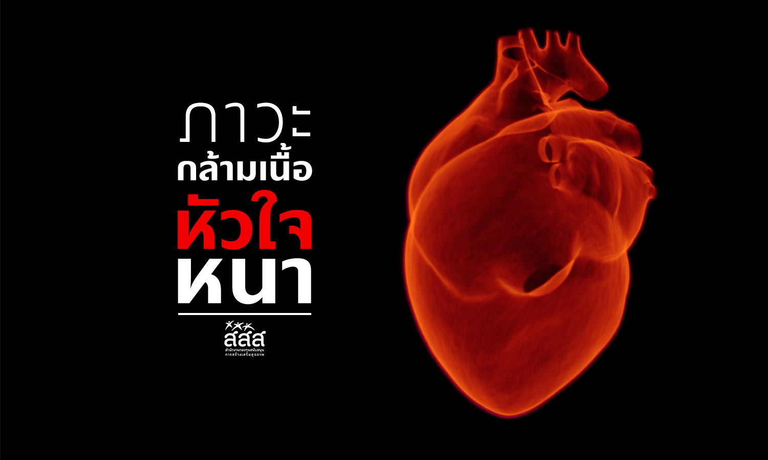 Hypertrophic Cardiomyopathy